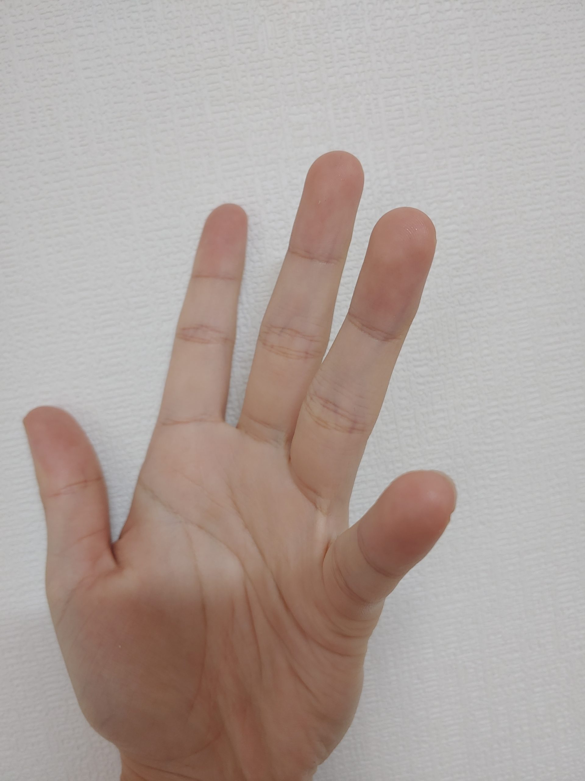 주짓수 부상이 발생하기 쉬운 케이스